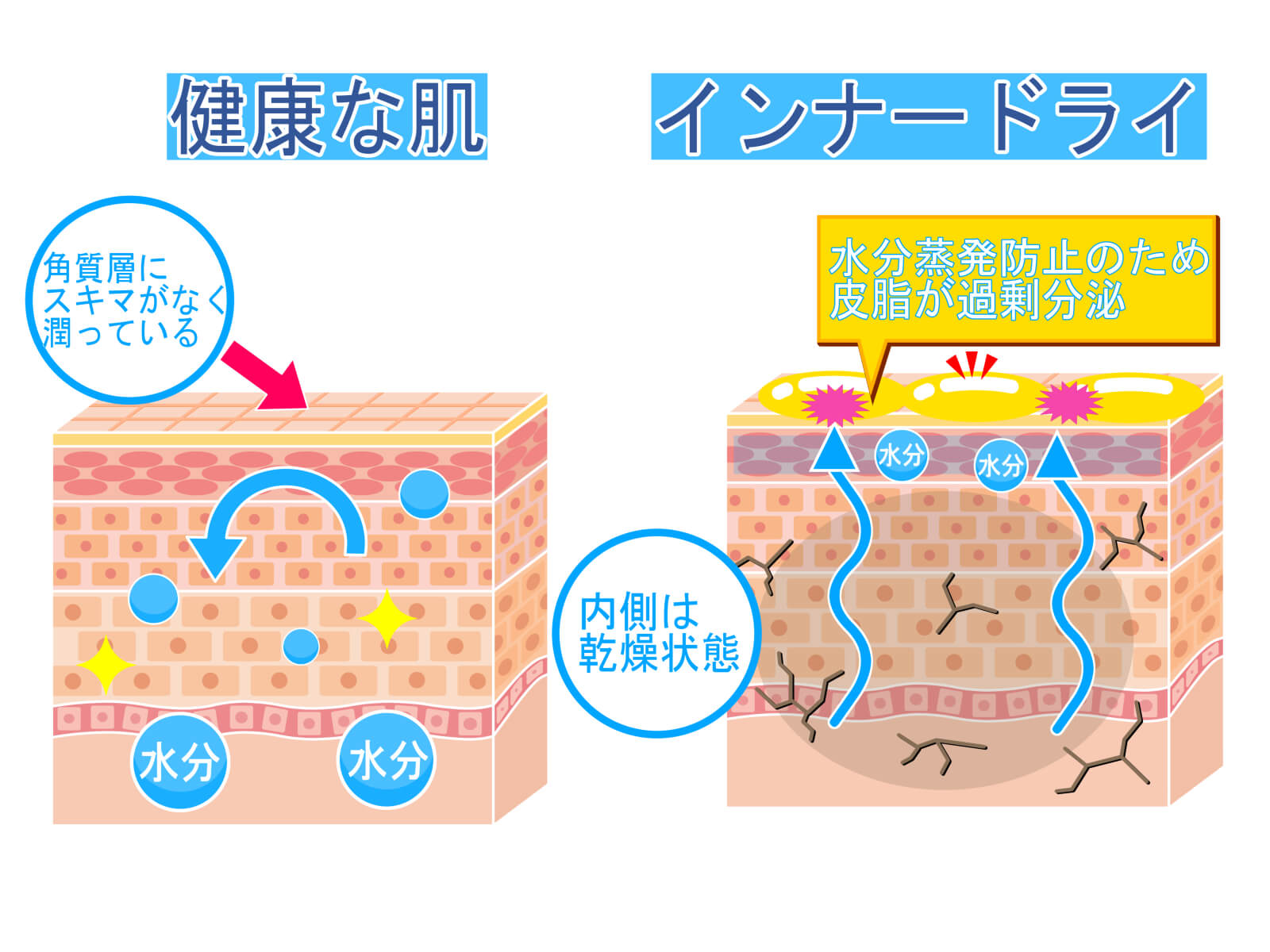 インナードライの私がグリセリンフリーとセラミドで乾燥対策してみた結果をご紹介！ なちゅらぼ